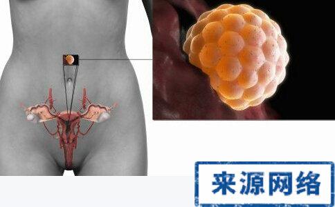 17����Ů1.5����������ɥ�� �ѳ������ӹ��಻��