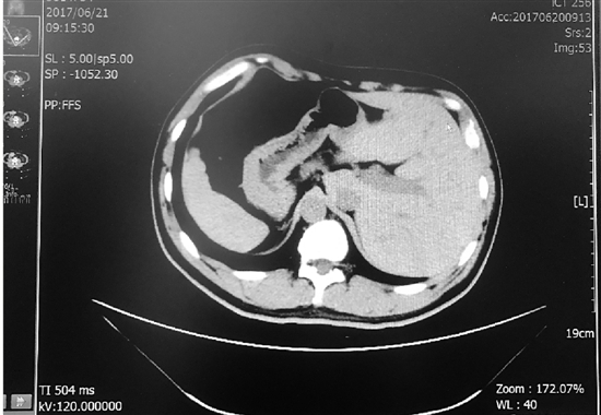 �����������������ų� Ϊ�������������Խת��